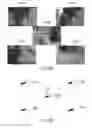 Fig. 30 - Algorithm and device for image processing