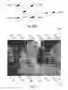 Fig. 32 - Algorithm and device for image processing