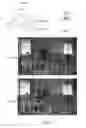 Fig. 34 - Algorithm and device for image processing