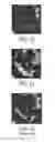 Fig. 10 - Perfusion imaging