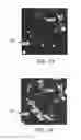 Fig. 11 - Perfusion imaging