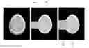 Fig. 01 - Method for eliminating artifact by detecting fracture of the brain in the computed tomography image and the computed tomography apparatus thereof