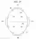 Fig. 16 - Method for eliminating artifact by detecting fracture of the brain in the computed tomography image and the computed tomography apparatus thereof
