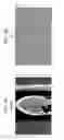 Fig. 09 - Method and system for substantially reducing cone beam artifacts based upon image domain differentiation in circular computer tomography (CT)