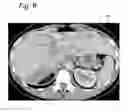 Fig. 06 - Grouping image annotations