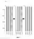 Fig. 14 - Vertical gate stacked NAND and row decoder for erase operation