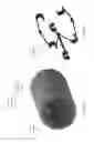 Fig. 09 - Quench protected structured superconducting cable