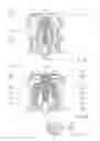 Fig. 04 - Key stem for a key module of a key for a keyboard, key module of a key for a keyboard, and method for manufacturing a key module for a key for a keyboard