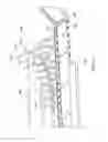Fig. 13 - Tape-based epitaxial lift off apparatuses and methods