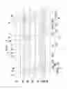 Fig. 22 - Thin film transistor, and thin film transistor array panel and organic light emitting diode display including the same