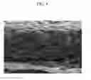 Fig. 05 - POSITIVE ELECTRODE FOR RECHARGEABLE LITHIUM BATTERY AND METHOD OF PREPARING SAME, NEGATIVE ELECTRODE FOR RECHARGEABLE LITHIUM BATTERY AND METHOD OF PREPARING SAME