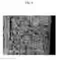 Fig. 10 - POSITIVE ELECTRODE FOR RECHARGEABLE LITHIUM BATTERY AND METHOD OF PREPARING SAME, NEGATIVE ELECTRODE FOR RECHARGEABLE LITHIUM BATTERY AND METHOD OF PREPARING SAME