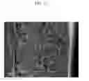 Fig. 12 - POSITIVE ELECTRODE FOR RECHARGEABLE LITHIUM BATTERY AND METHOD OF PREPARING SAME, NEGATIVE ELECTRODE FOR RECHARGEABLE LITHIUM BATTERY AND METHOD OF PREPARING SAME