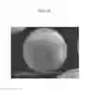 Fig. 03 - Electrode for rechargeable lithium battery and rechargeable lithium battery including the same