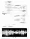 Fig. 15 - AUDIO SIGNAL SIZE CONTROL METHOD AND DEVICE