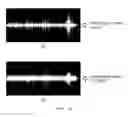 Fig. 23 - AUDIO SIGNAL SIZE CONTROL METHOD AND DEVICE