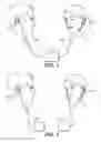 Fig. 02 - Assisting Conversation in Noisy Environments