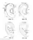 Fig. 02 - Noise mitigating microphone system