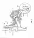 Fig. 03 - Noise mitigating microphone system