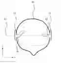Fig. 01 - Hearing aid with an antenna