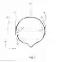 Fig. 02 - Hearing aid with an antenna