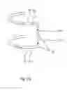 Fig. 10 - Hearing aid with an antenna