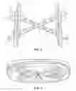 Fig. 04 - Lawnmower blade holder device
