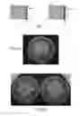Fig. 02 - Oxidizing alkaline biodecontamination gel and surface biodecontamination method using said gel