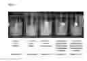 Fig. 08 - CREAMER COMPOSITION COMPRISING PLANT PROTEIN MICROPARTICLES