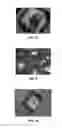 Fig. 05 - TABLET COMPRISING FRUCTOSE