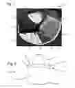 Fig. 02 - Face shield attachment assembly