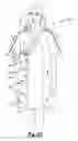 Fig. 03 - Adjustable front-opening hospital gown