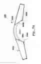 Fig. 13 - Sleeved partial undergarment and methods of use