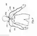Fig. 16 - Sleeved partial undergarment and methods of use