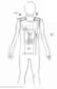 Fig. 01 - MEDICAL GARMENT