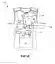 Fig. 25 - MEDICAL GARMENT