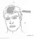 Fig. 30 - Hair restoration system and method