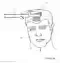 Fig. 31 - Hair restoration system and method