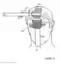 Fig. 36 - Hair restoration system and method