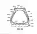 Fig. 30 - Decoupled foot stabilizer system