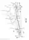 Fig. 12 - Shoe sole with energy restoring device