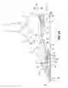 Fig. 15 - Shoe sole with energy restoring device