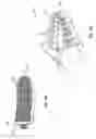 Fig. 07 - Solventless fire ignition systems and methods thereof