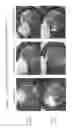 Fig. 05 - Flushable wipes