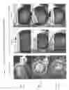 Fig. 06 - Flushable wipes