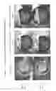 Fig. 08 - Flushable wipes