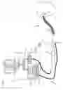 Fig. 02 - Location of fragments during lithotripsy