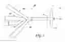 Fig. 03 - Indwelling bladder catheter