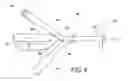 Fig. 04 - Indwelling bladder catheter