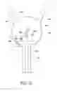 Fig. 11 - Indwelling bladder catheter